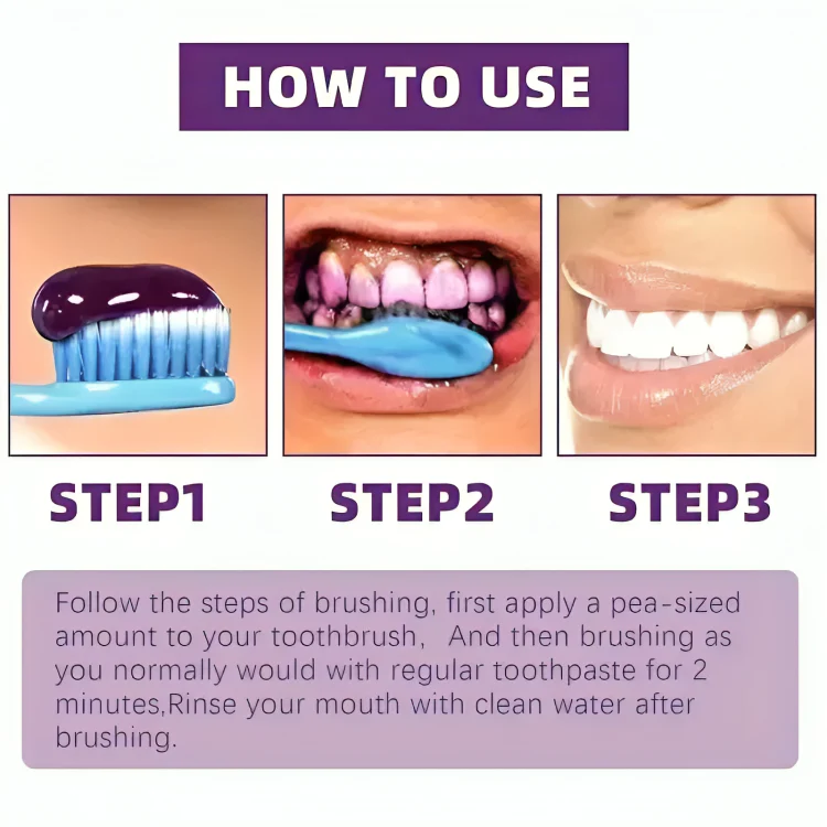 BrightSmile - Teeth Whitening Smilekit